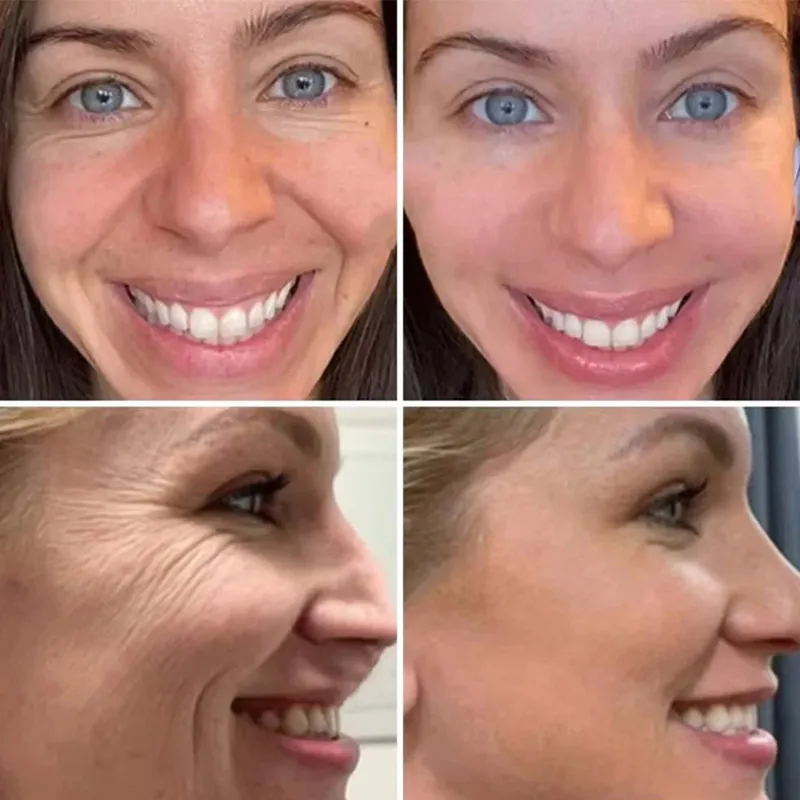 Facial Serum Retinol Wrinkle Remover Face Set Instant Firming Lifting Anti-Aging Fade Fine Lines Whitening Korean Skin Care