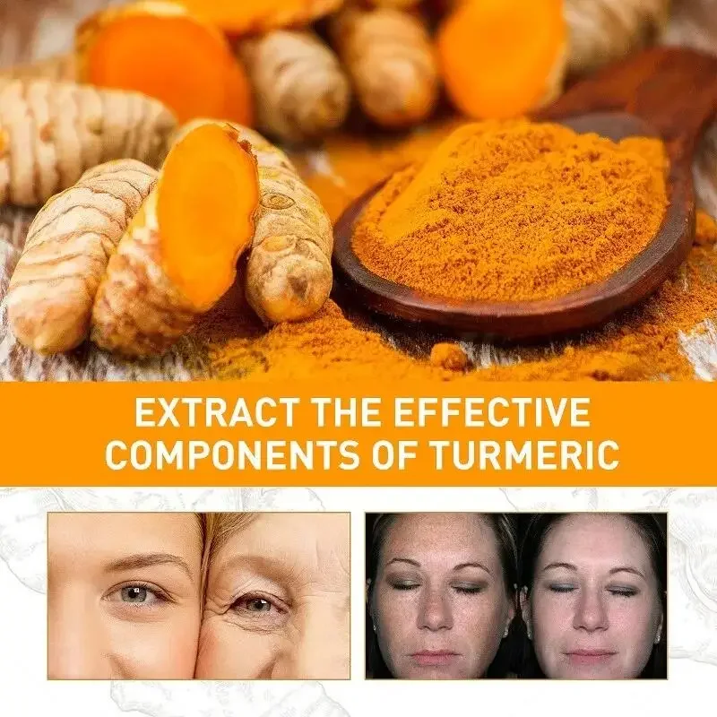 O açafrão que alvejante o soro facial, sardas, remove pontos escuros, melasma ilumina, melanina, cicatriz da acne, antienvelhecimento, firme ilumina