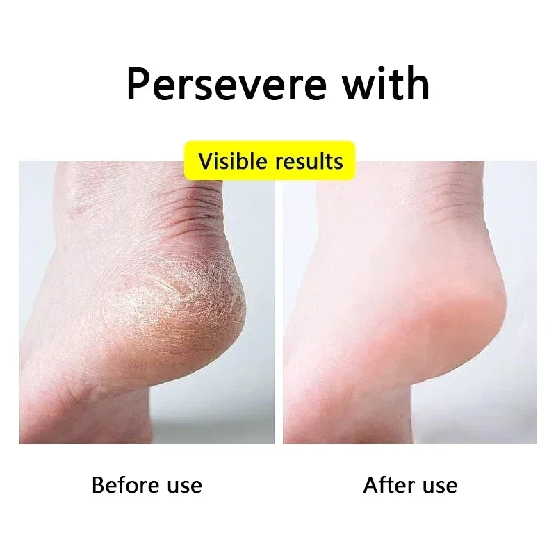 Silicone Feet Pads Heel Moisturizing Toeless Socks Heel Repair Unisex heel protector pads