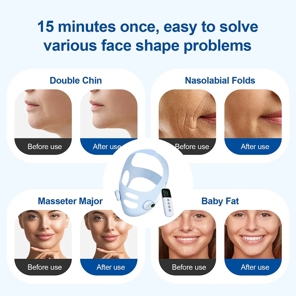 Electric Face Slimming Bandage V Line Face Shaper Chin Cheek Lift Up Belt Facial Massage Strap Edema Removal Mask Cheek Slimmer