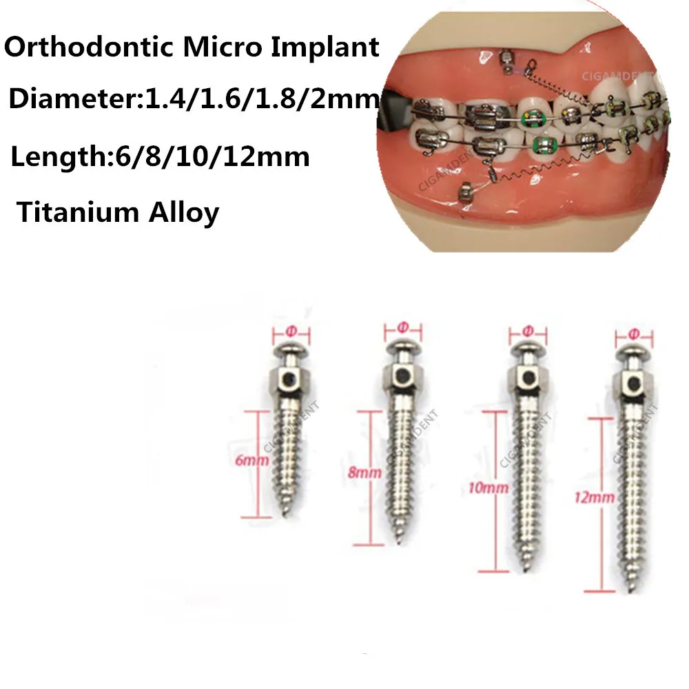 

100Pcs Dental Orthodontic Mini Implant Micro Screws Titanium Alloy Implant Screwdriver Wrench Self-Drilling 1.4/1.6/1.8/2.0mm