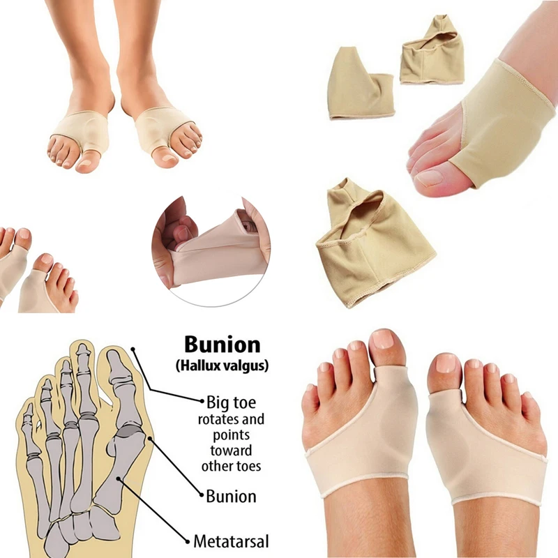 

2Pcs Adjuster Correction Pedicure Socks Bunion Straightener Feet Care Big Toe Hallux Valgus Corrector Orthotics Bone Thumb