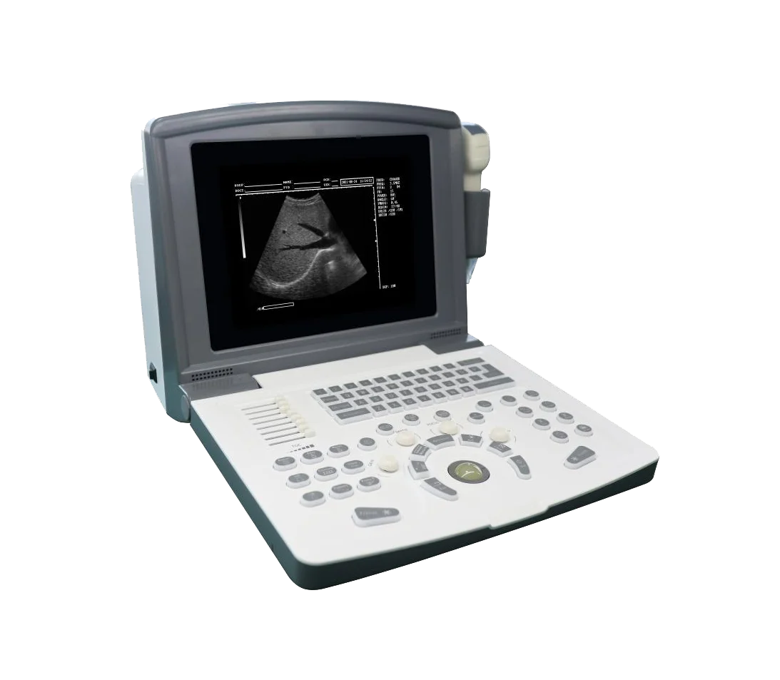 

KR-1288Z black and white fully digital B-mode ultrasound scanner