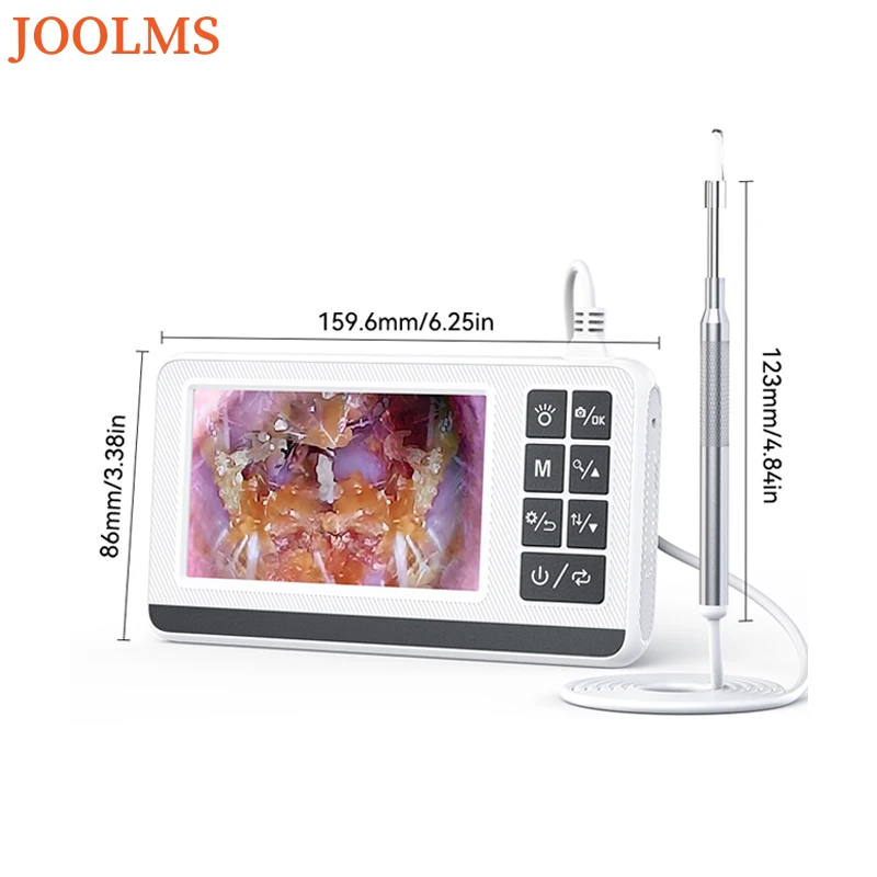 Цифровой отоскоп с экраном 4