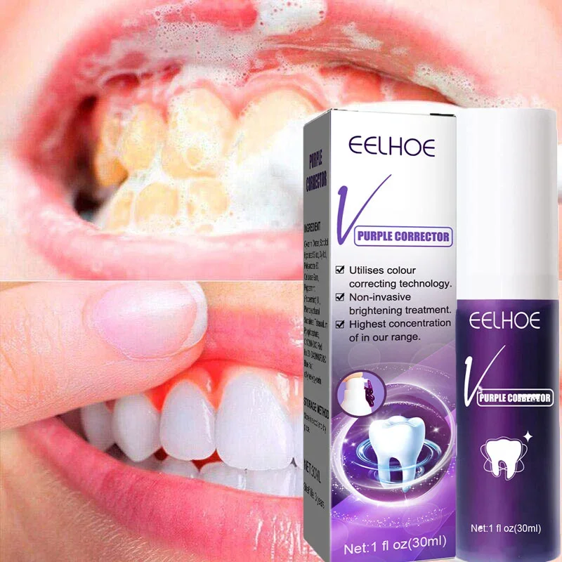 Whitening Tooth Toothpaste Removal Smoke Stains Oral Hygiene Clean Effectively Freshen Breath Removal Yellow Teeth Dental Care