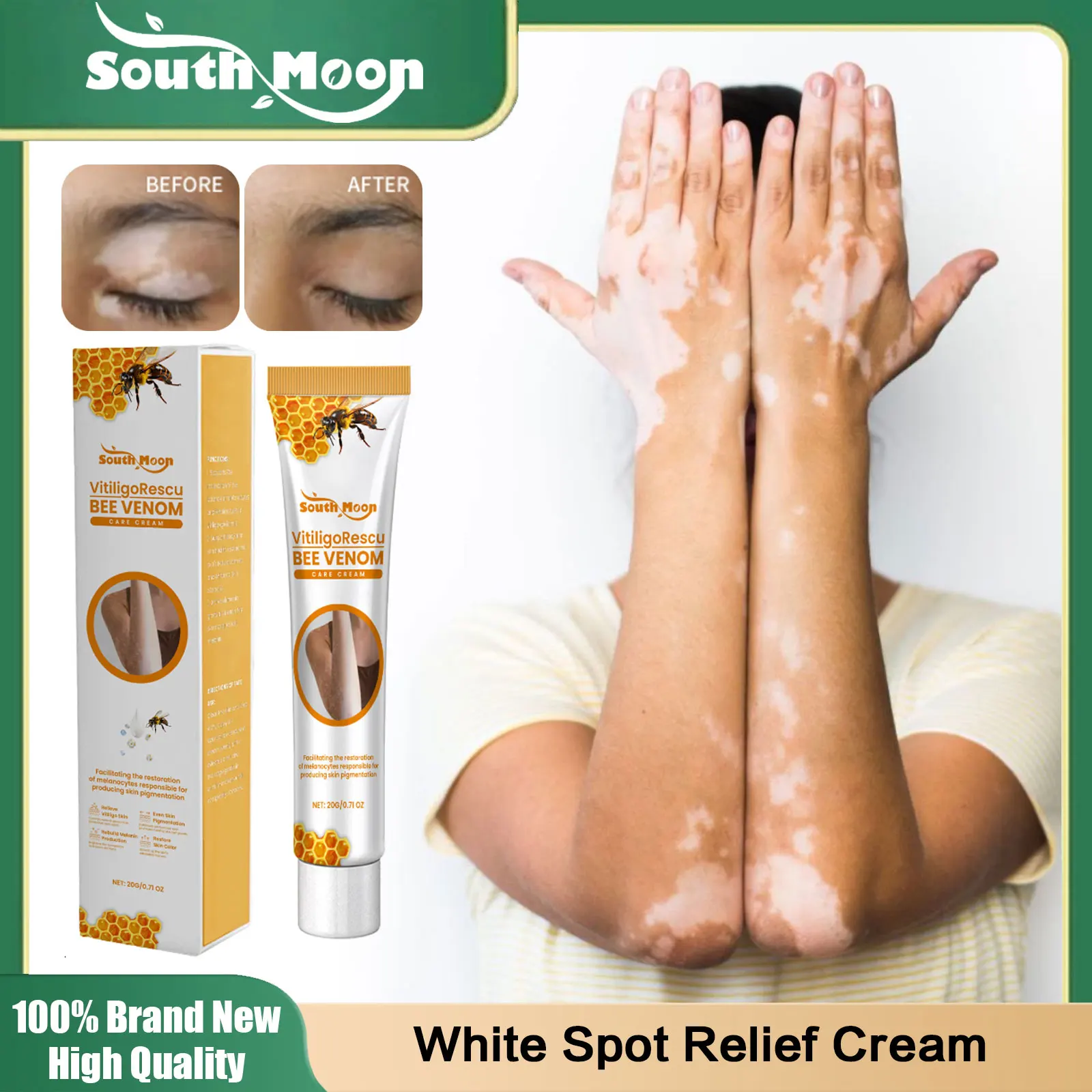 Vitiligo Relief Cream Leukoplakia Mycosis Soothing Ointment Remove White Spots Promote Melanin Production Moisturizing Skin Care
