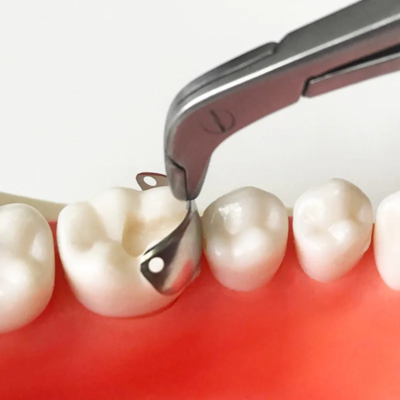 Dental-Schnittmatriziensystem, abschnittsweise konturierte Metallmatrizenbänder, Nickel-Titan, universelle/schmale Klemmen, zahnmedizinische Materialien – Detail 5