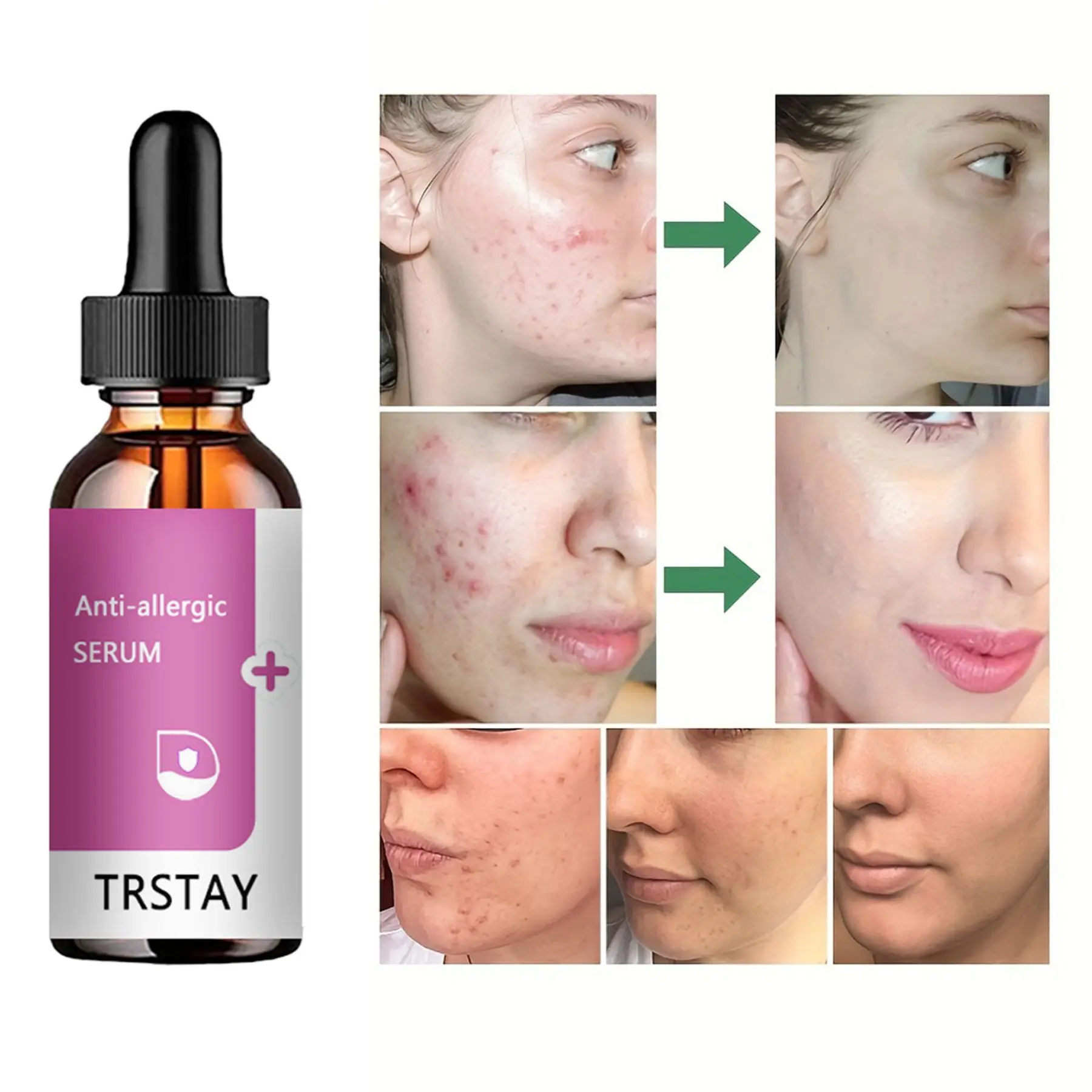 

Anti-Allergic Serum Moisturizing Nourish Repair Sooth Skin Removes Redness Anti-Inflammatory Essence Oil Face Skin Care Product