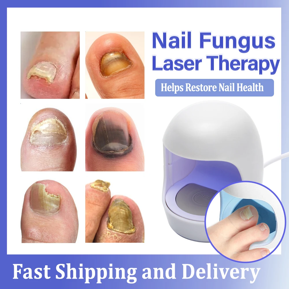 Anti Fungal Laser Device Repair Toenail Fingernail Fungus Treat Onychomycosis Therapy Cure Machine Effectively Remove