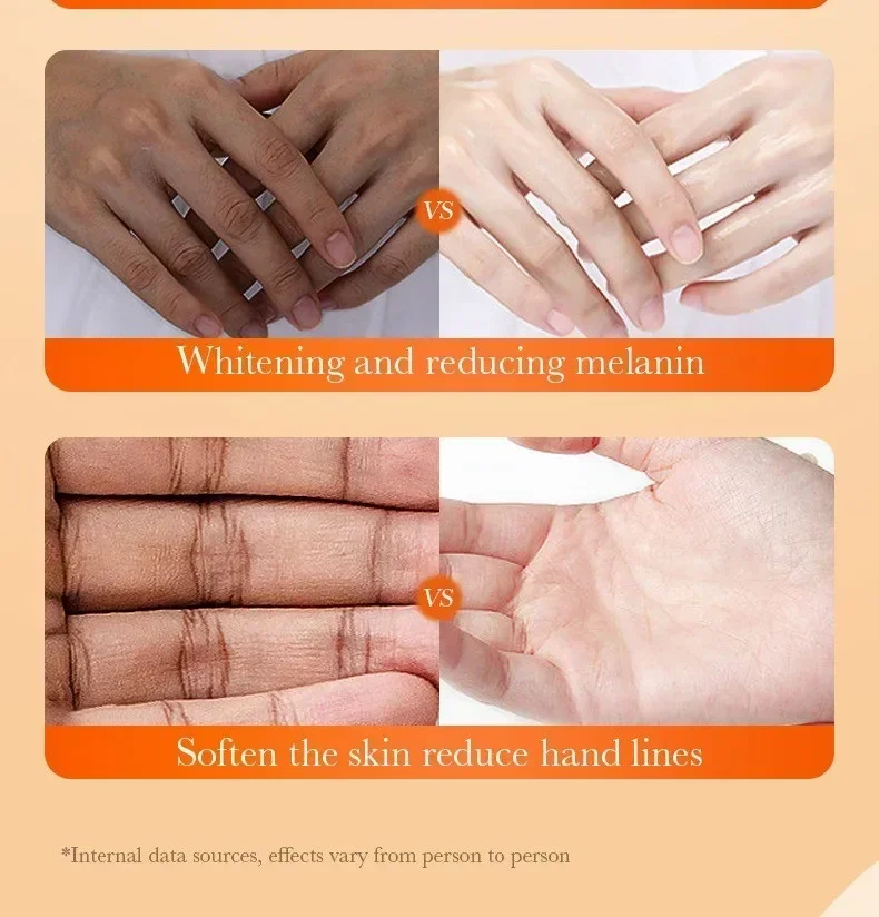 Dark Knuckles Fast Brightening Serum Hand Anti Cracking Cream Fingers Brighten Moisturiz For Dark Skin Stains Remover Products