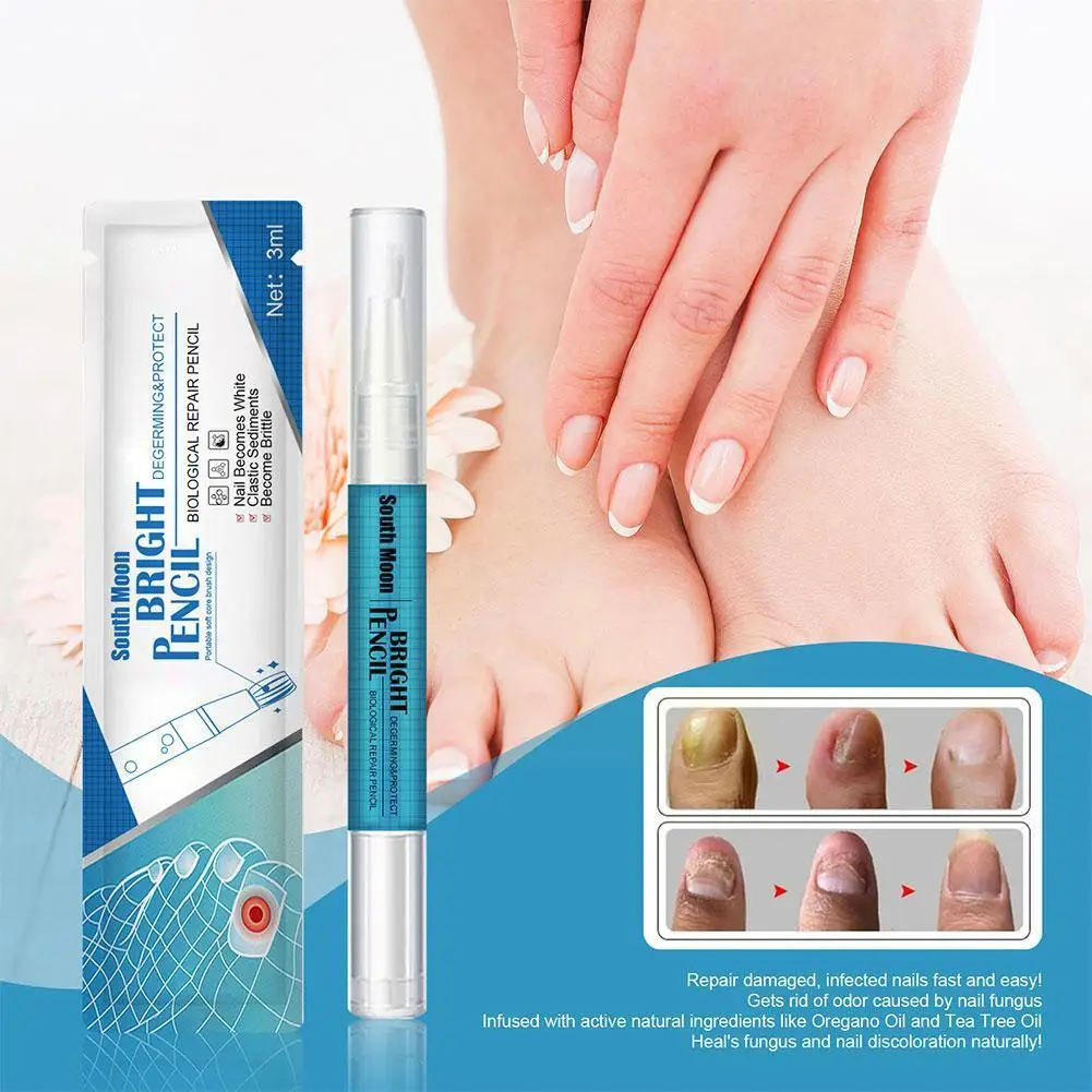 3ml Nail Fungal Treatment Pen Feet Care Nail Foot Toe Paronychia