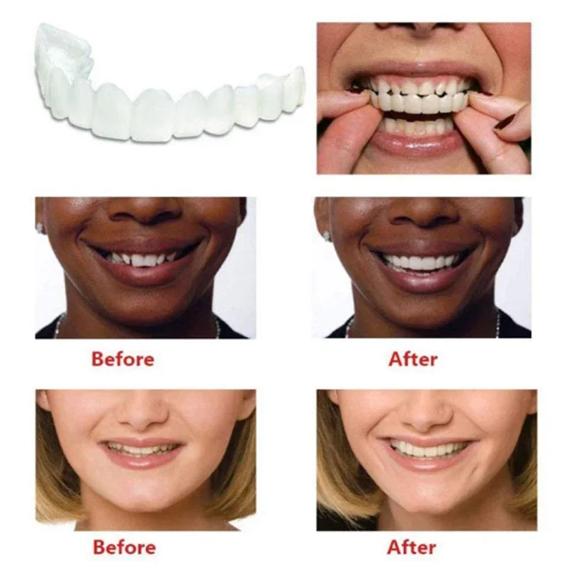

Sdotter New Fake Tooth Cover Perfect Fit Teeth Whitening Teeth Snap on Silicone Smile Veneers Teeth Dental Flexibles Beauty Tool