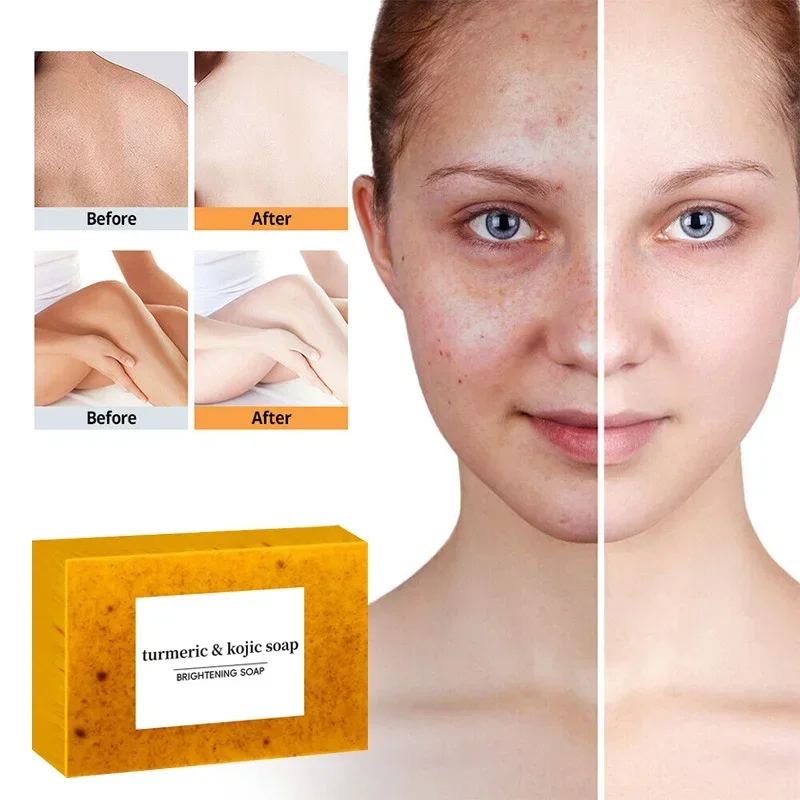 100g Turmeric Scrub Exfoliator Handmade Soap,Lemon Kojic Acid Brighten Moisturizing Shower Face Cleansing Soap,Body Skin Cleaner 3