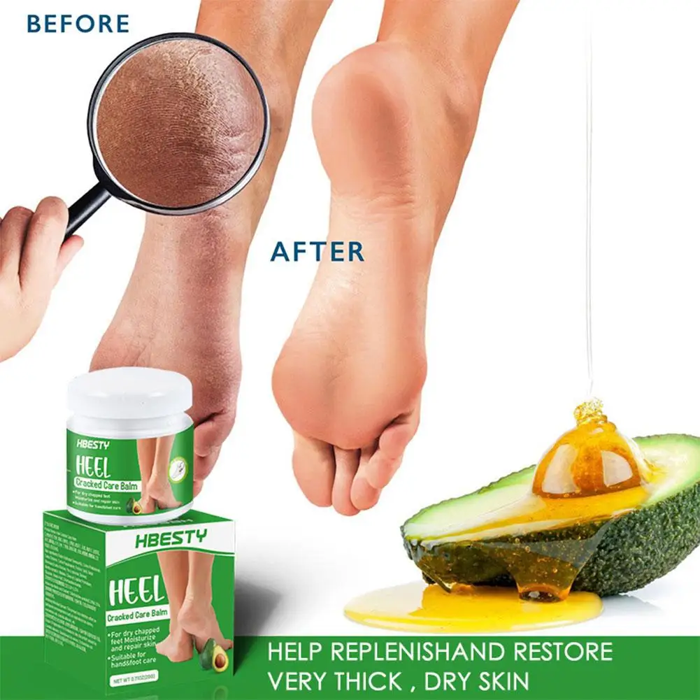 

20g Avocado Hand Cream, Hand And Foot Chap Cream, Nourishing Cream, Products And Repairing And Foot Care Hand Moisturizing X5T8