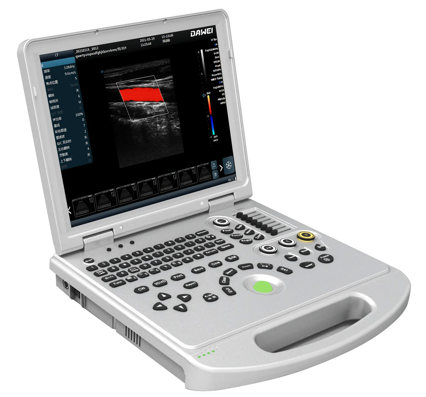 Dw-L50 (Dw-L5Pro) Ecografo Portatil 3D/4D/5D Color Doppler Ultrasound Machine