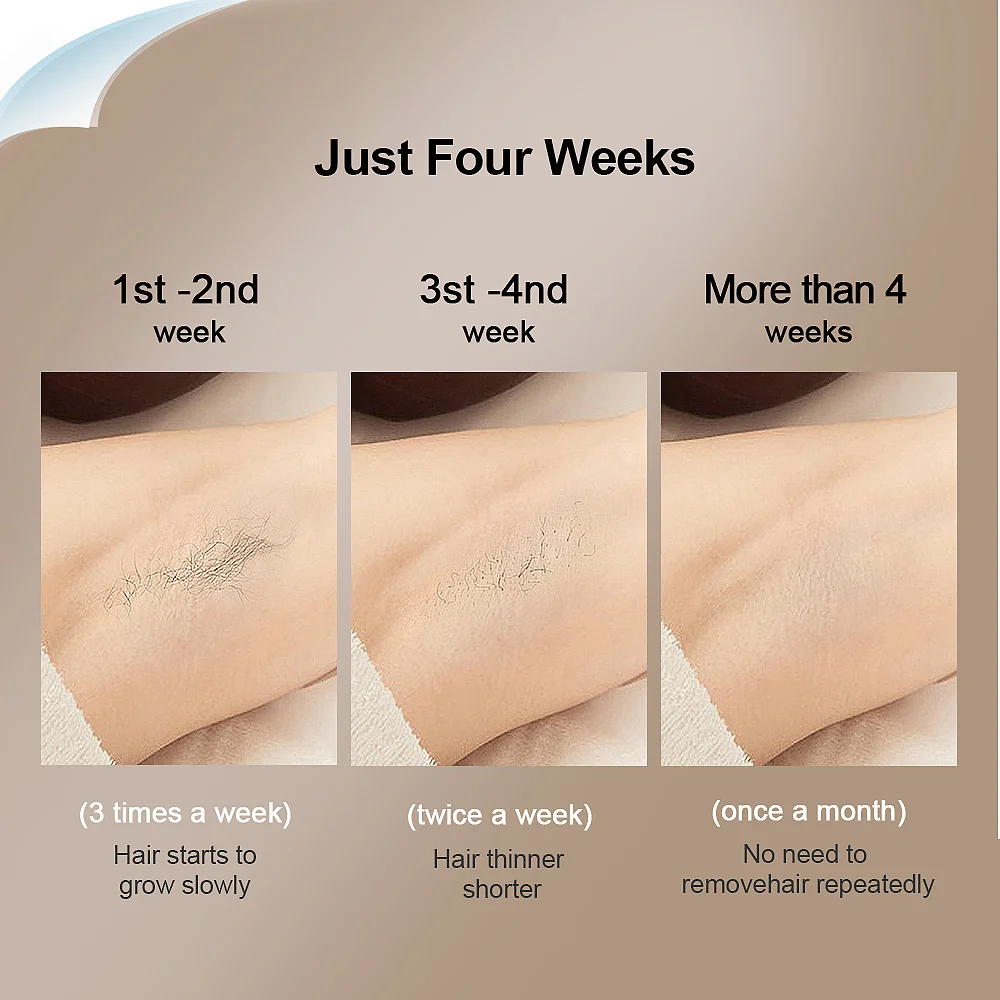 3イン1光脱毛器 レーザー脱毛器 Amazon | JIN BISON 3イン1脱毛器 だつもうき 光エストムダ毛