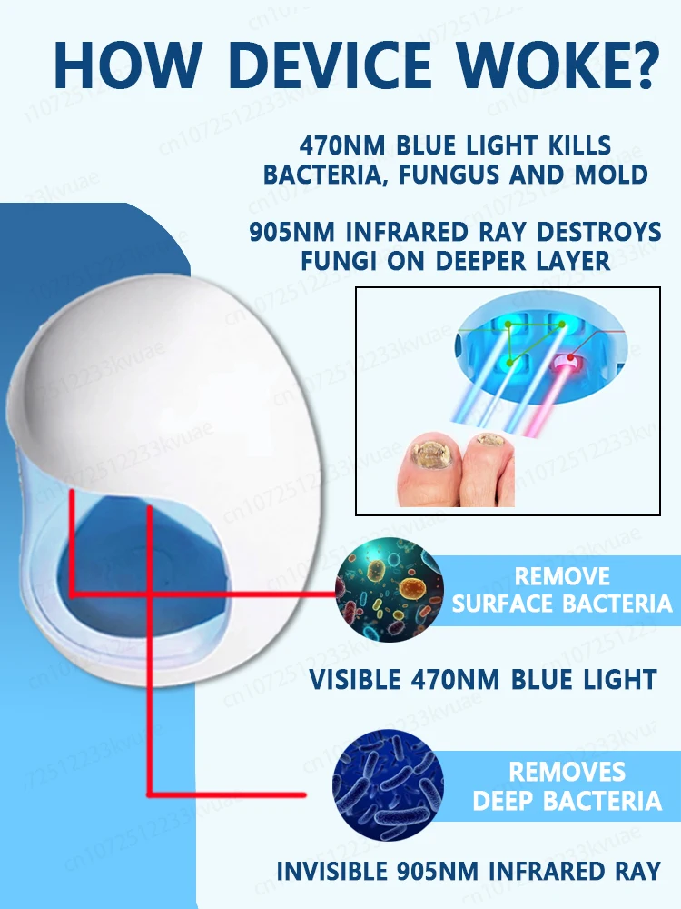 Laser Product To Solves Nail troubles