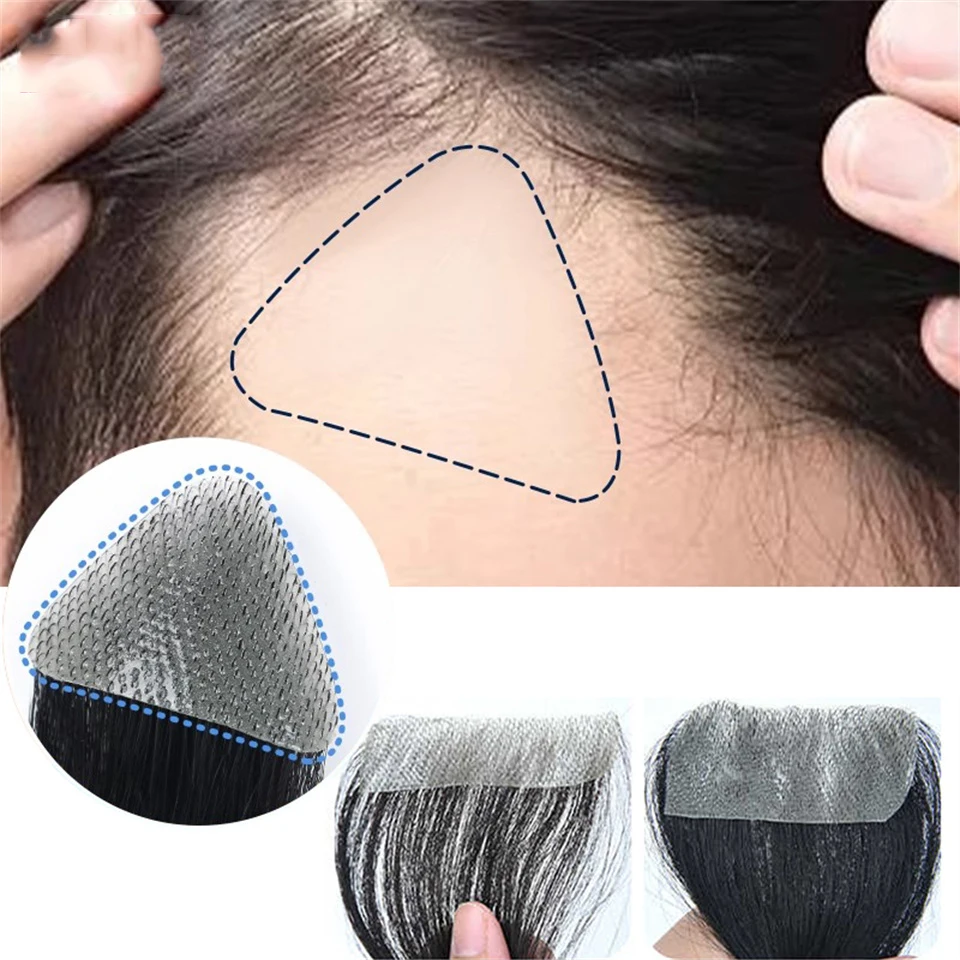 Brown Human Hair Wig Capillary Prosthesis For Male Forehead