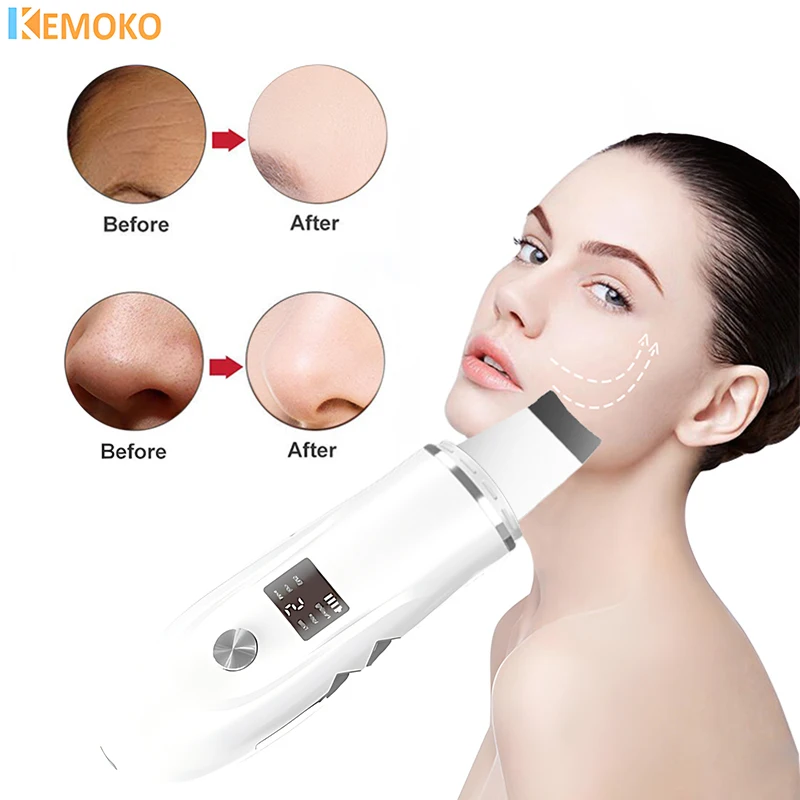 Ultrasonic Skin Scrubber Remover Blackhead Ultrasonic Peeling Facial Scrubber Shovel Deep Cleaning Face Remove Pore Acne Lifting