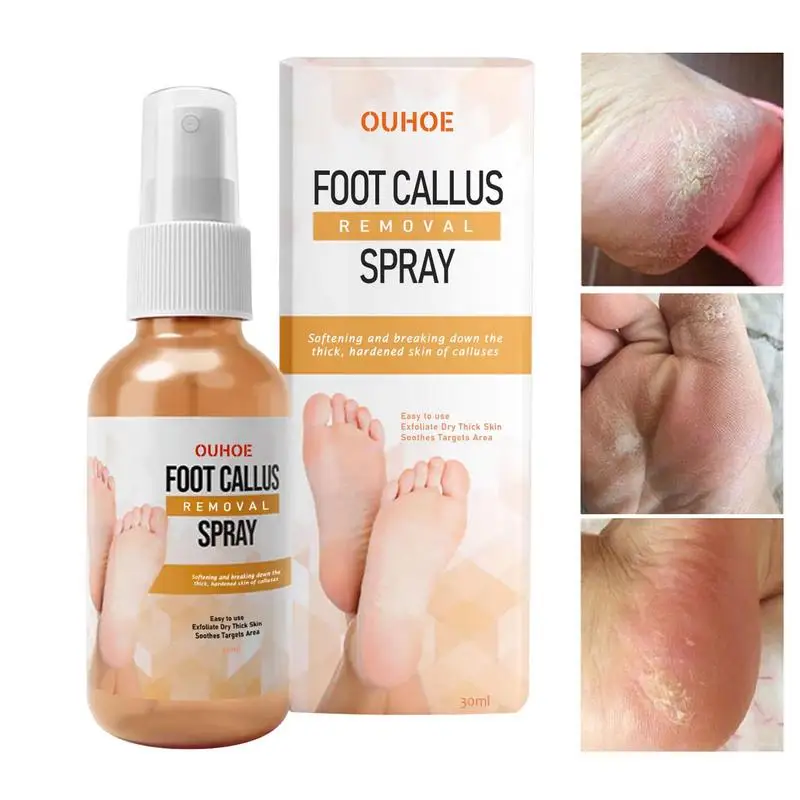 Callus Removal Extra Thick Foot Calluses