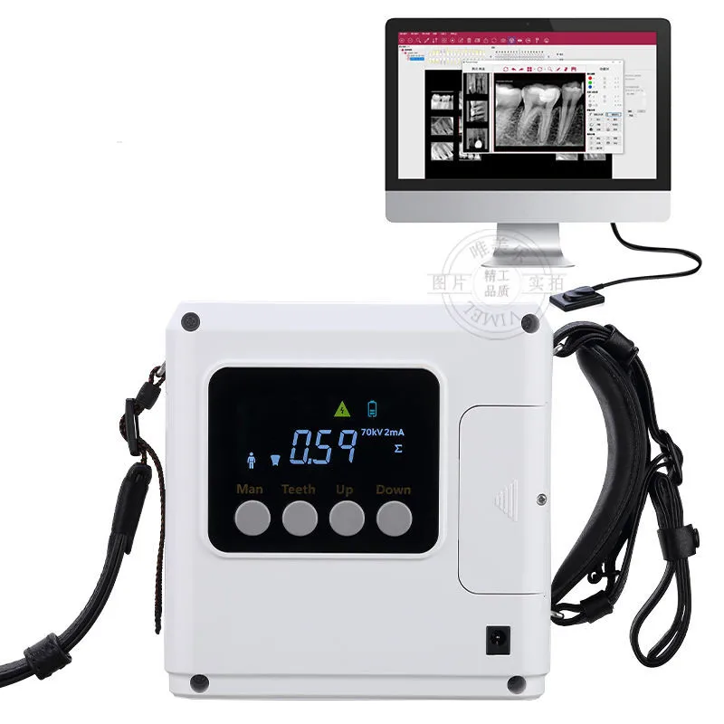 

70Kv Lightweight Runyes Original den tal Portable Digital X ray Machine High Frequency Ray X Dentist Equipment for Clinic