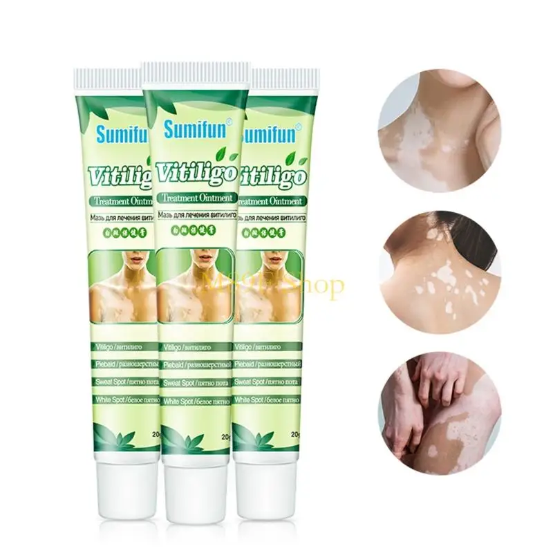 M89F 20g White Spot Localized VitiligoTreament Cream Cream Ointment Mycosis Leukoplakia