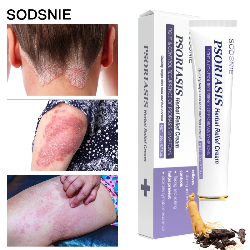 5pcs Herbal Cream Psoriasis Eczema Antifungal Scaling Treatment Repair