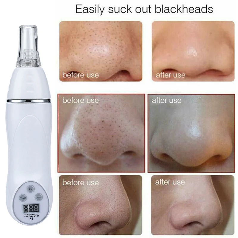 Microdermabrasion Exfoliation Home Use Blackhead Acne Removal Beauty Device Microdermabrasion Diamond Peeling Vacuum Machine Facial Skin Care Scar Faded Set