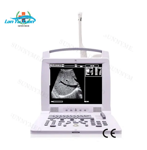 

SY-A005 Simple Portable Animal Vet Ultrasound Scanner Price For Sale
