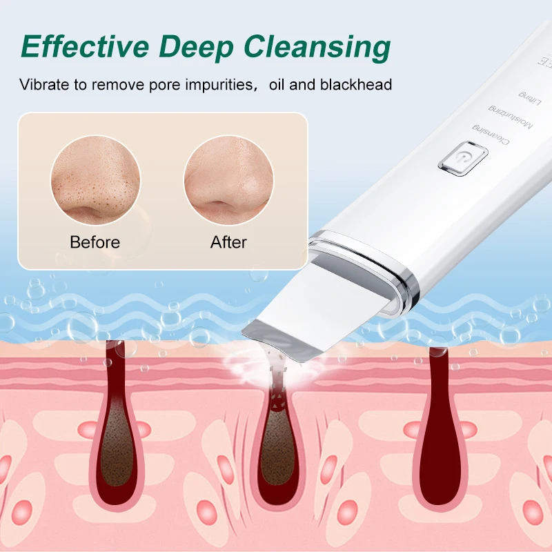 VLVEE Blackhead Removal Device Face Skin Scraper for Deep Cleansing Skin Scrubber Facial Spatula Nose Cleaner Care Tool
