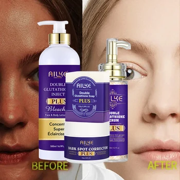 AILKE 더블 글루타티온 표백 스킨 케어 제품, 주근깨 제거, 기미, 멜라닌, 지지대 개인 맞춤형 도매