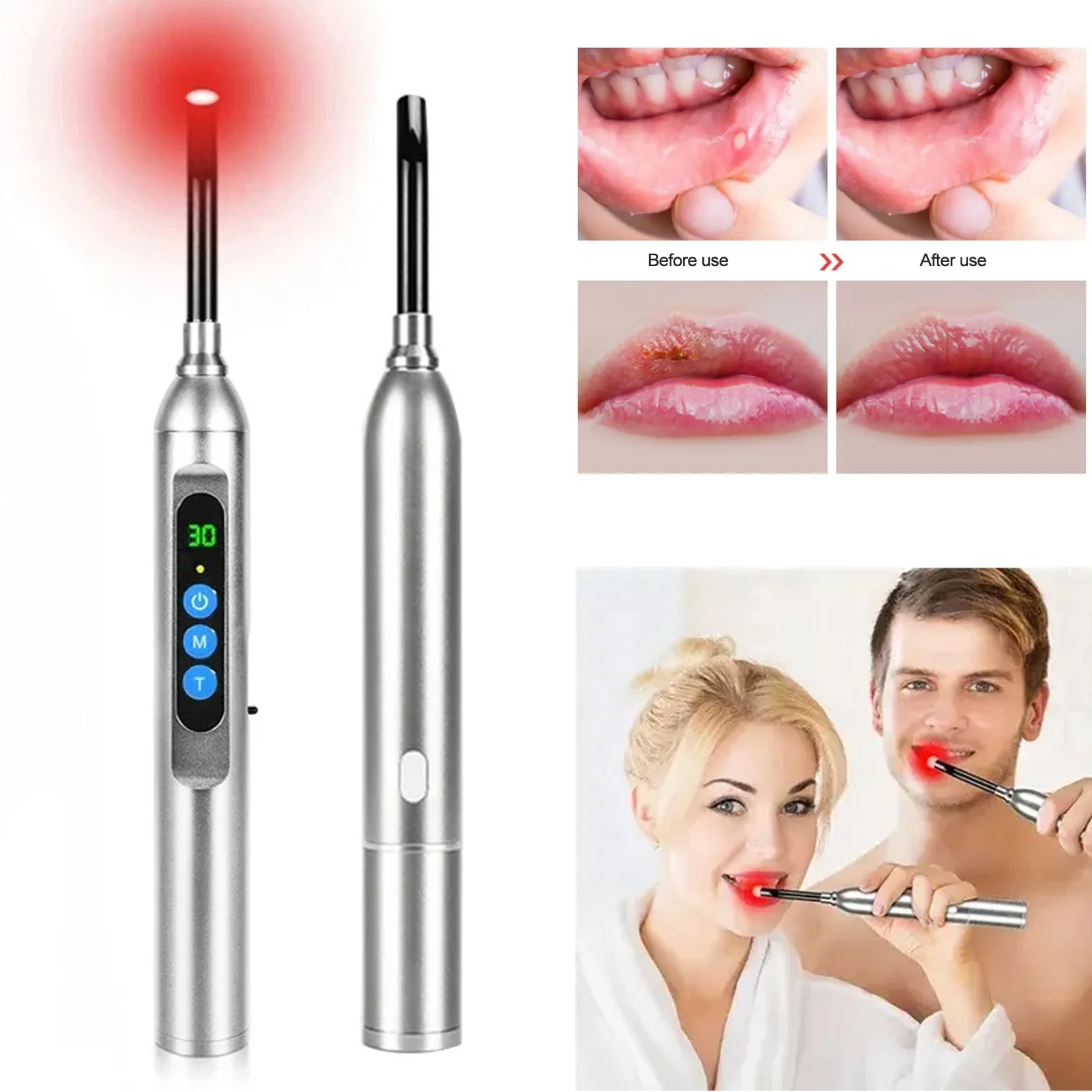 Red Light Therapy Device Canker Sore Cold Sore Treatment Infrared Light Therapy Wand for Mouth Nose Ear Knee Feet Hands Ankle