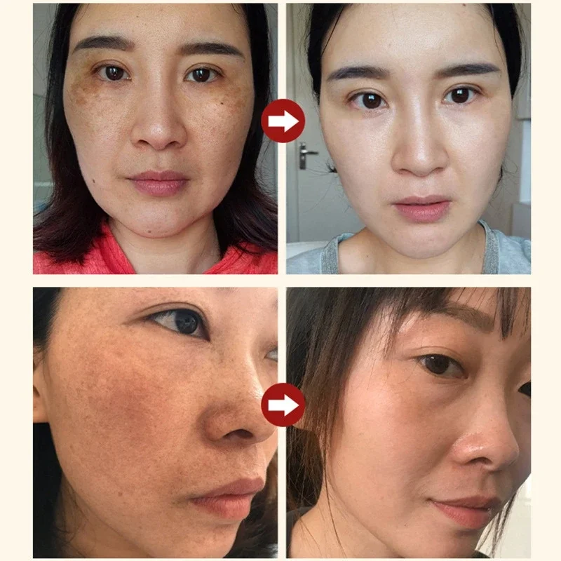 Niacinamide Facial Serum Salicylic Acid Moisturizing Skin Care Products 2024 2