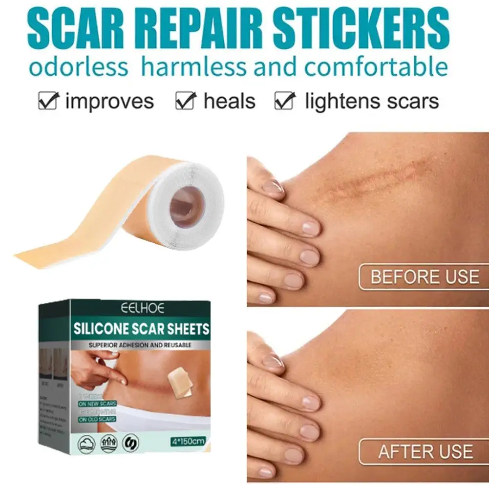 Silicone Scar Sheets Patch Painless Scar Repair Tape Roll Effective Scar Removal Strips for C-Section Keloid Burn Acne mebak silicone scar sheets 1 6x60 inch scar repair tape roll clear scar removal strips for keloid and c section surgery keloid