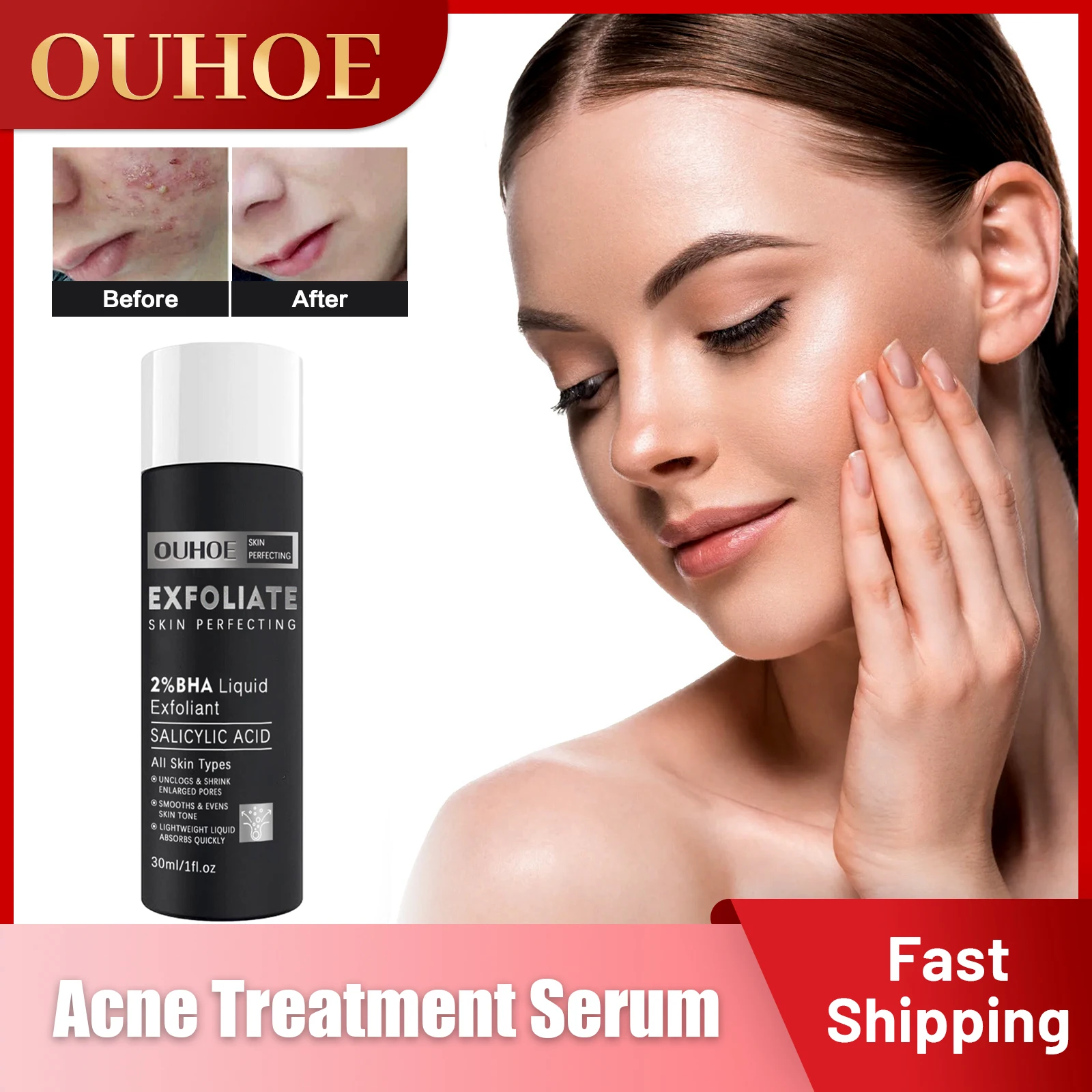 

Acne Treatment Serum Ordinary Salicylic Acid Serums Remove Pimples Blackheads Anti Acne Pores Shrink Skin Rejuvenation Essence