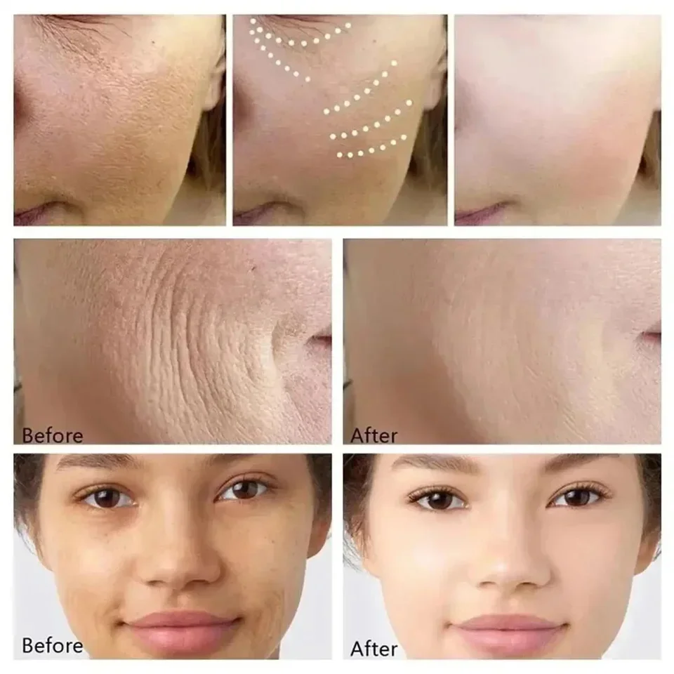 Retinol Facial Serum for Wrinkle Removal and Anti Aging