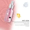 4 in 1 Anti Aging Serum Fade Fine Line Dark Spot Removal Pore Shrinking Skin Rejuvenation Moisturizing Hyaluronic Acid Essence 5