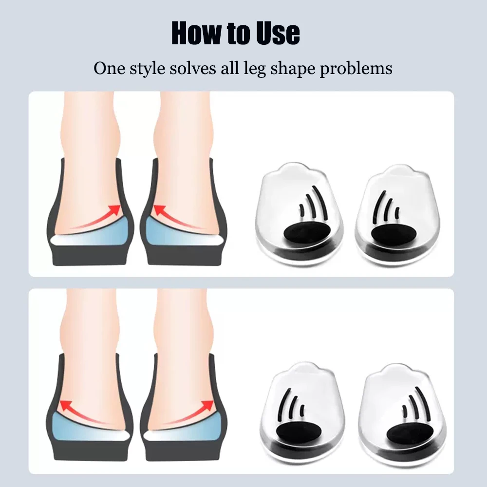 Magnetic Silicone Orthopedic Insoles for Shoes Men Women Plantar Fasciitis Relief O/X Legs Knee Varus Correction Feet Heel Pads