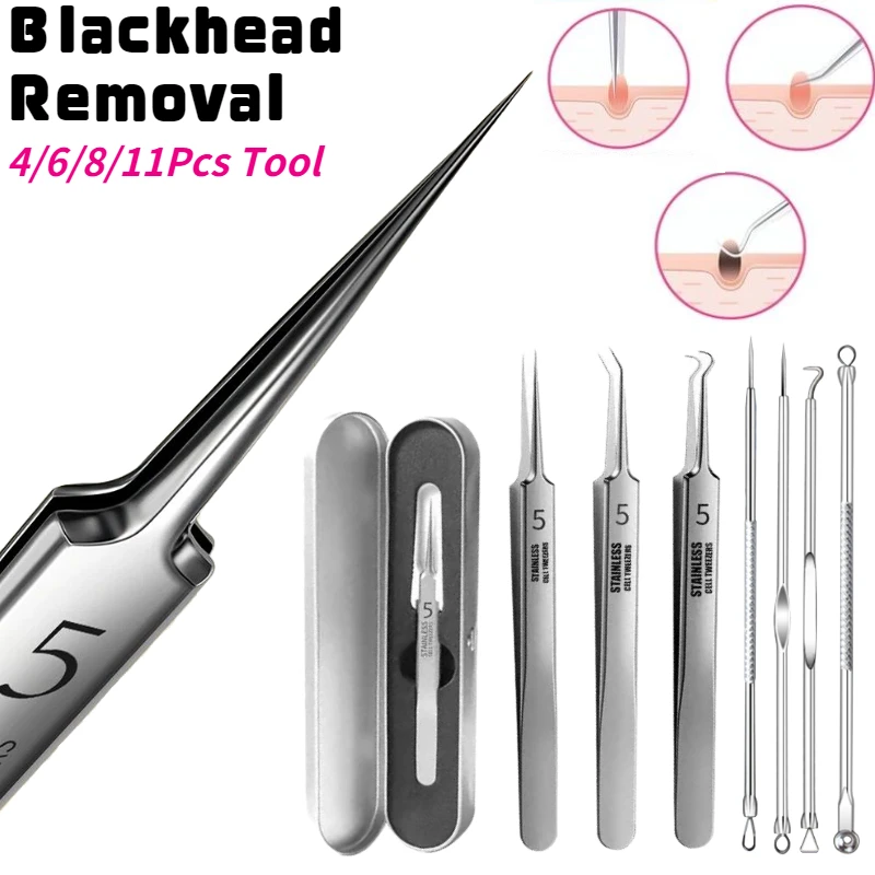 

German Acne Remover Needles Blackhead Removal Pimple Comedone Extractor Set Blemish Zit Face Skin Care Cleaner Removal Tools
