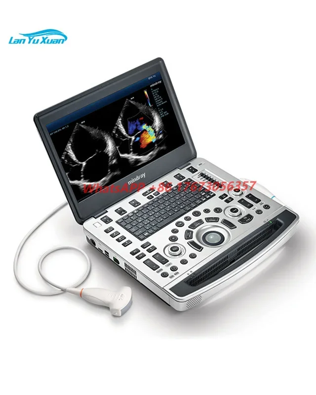 Портативный ультразвуковой аппарат