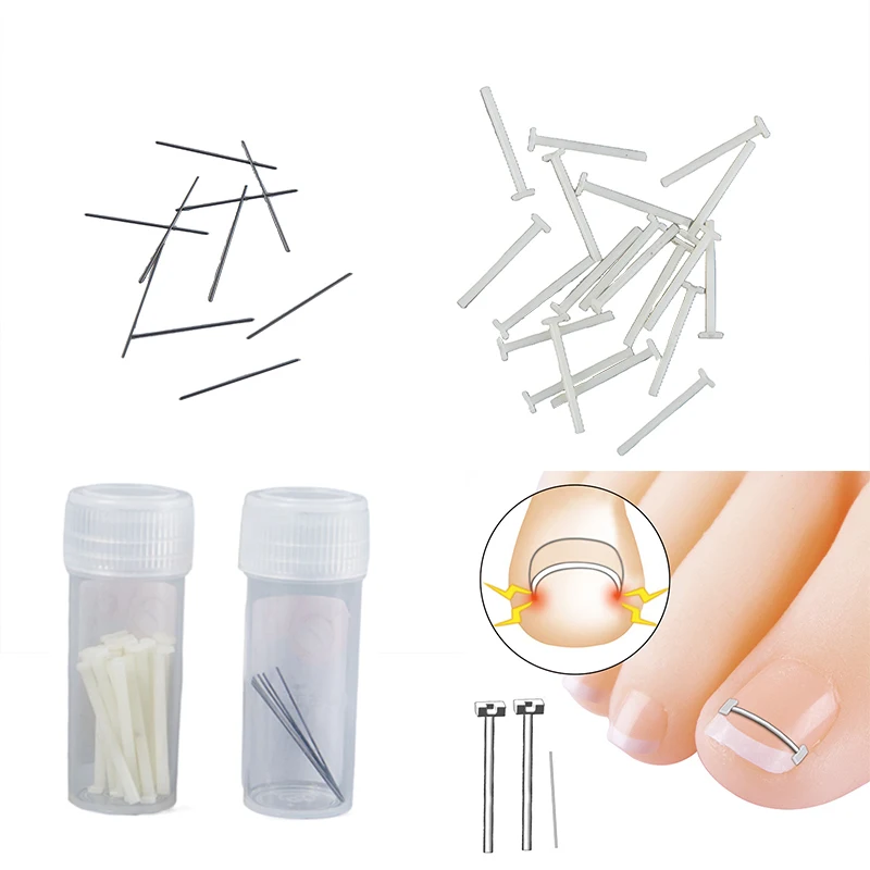 

Ingrown Toenail Corrector Tools Pedicure Recover Embed Toe Nail Treatment Professional Ingrown Toenail Correction Foot Care Tool