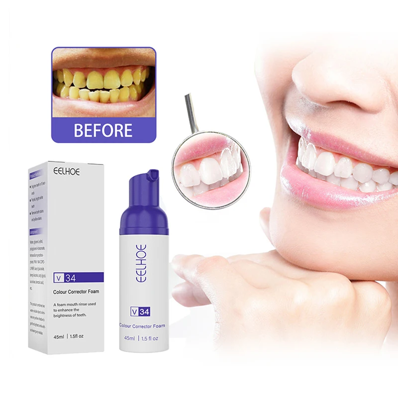 Teeth Whitening Mousse Removes Smoke Tea Coffee Stains Toothpaste Dental Bleaching Deep Cleaning Fresh Breath Oral Hygiene