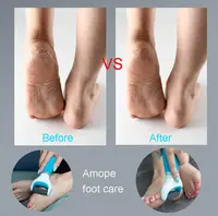 Electric Foot Callus Remover Scraper Foot Grinder File Dead Skin Removal USB Charge Battery Pedicure Care Tool Foot Exfoliation 2