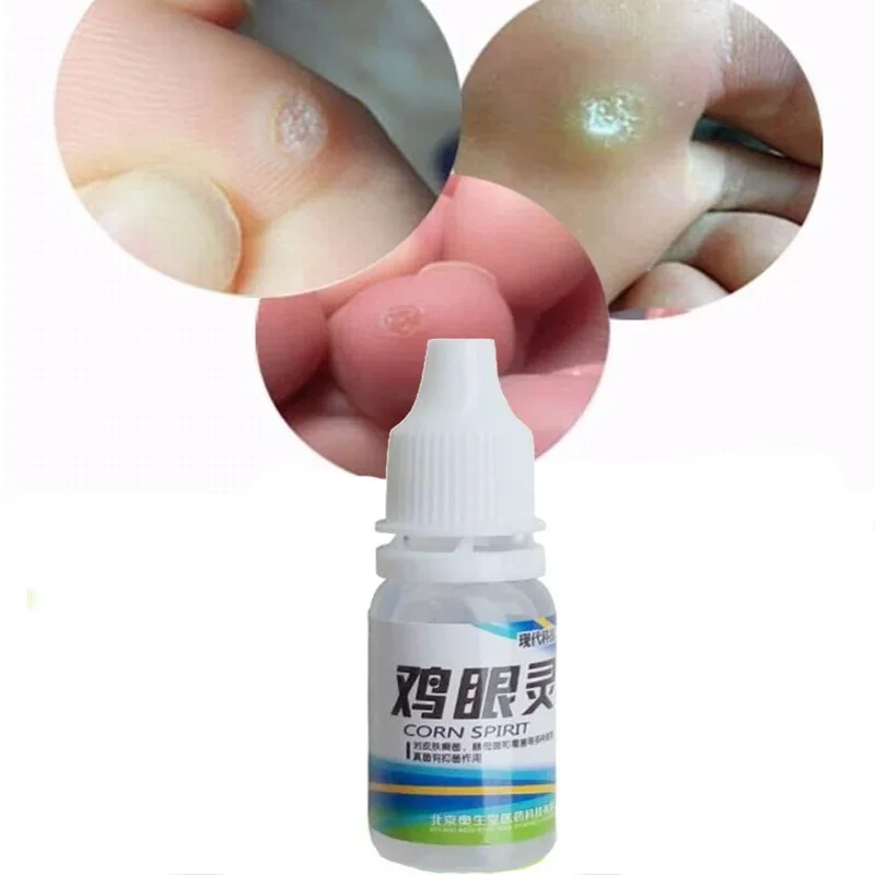 Powerful Foot Corn Callus Remover 10ml Pro nail problem solving white hair remover foot callus remover wrinkle remover