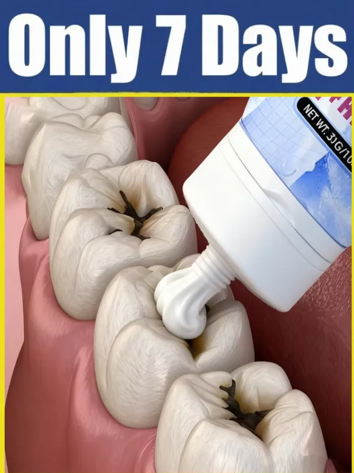 Dent amélioré de 3e génération réparer la racine dentaire uickly nettoie les bactéries buccales.