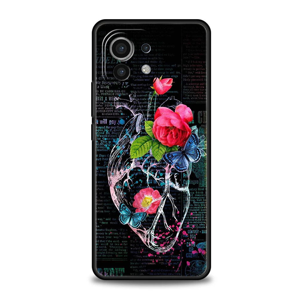 Herz Kunst Handy hülle für Xiaomi Poco F4 F3 X3 X4 X5 GT NFC M3 M4 11 Ultra 12 12T 13 Note 10 Pro Lite 5G Silikon hülle Capas Tasche – Detail 5