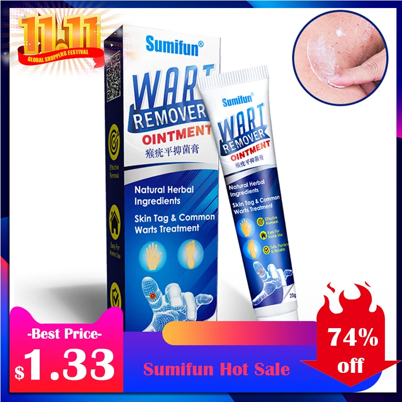 20g Sumifun Wart Removal Body Warts Treatment Cream Foot Care Cream
