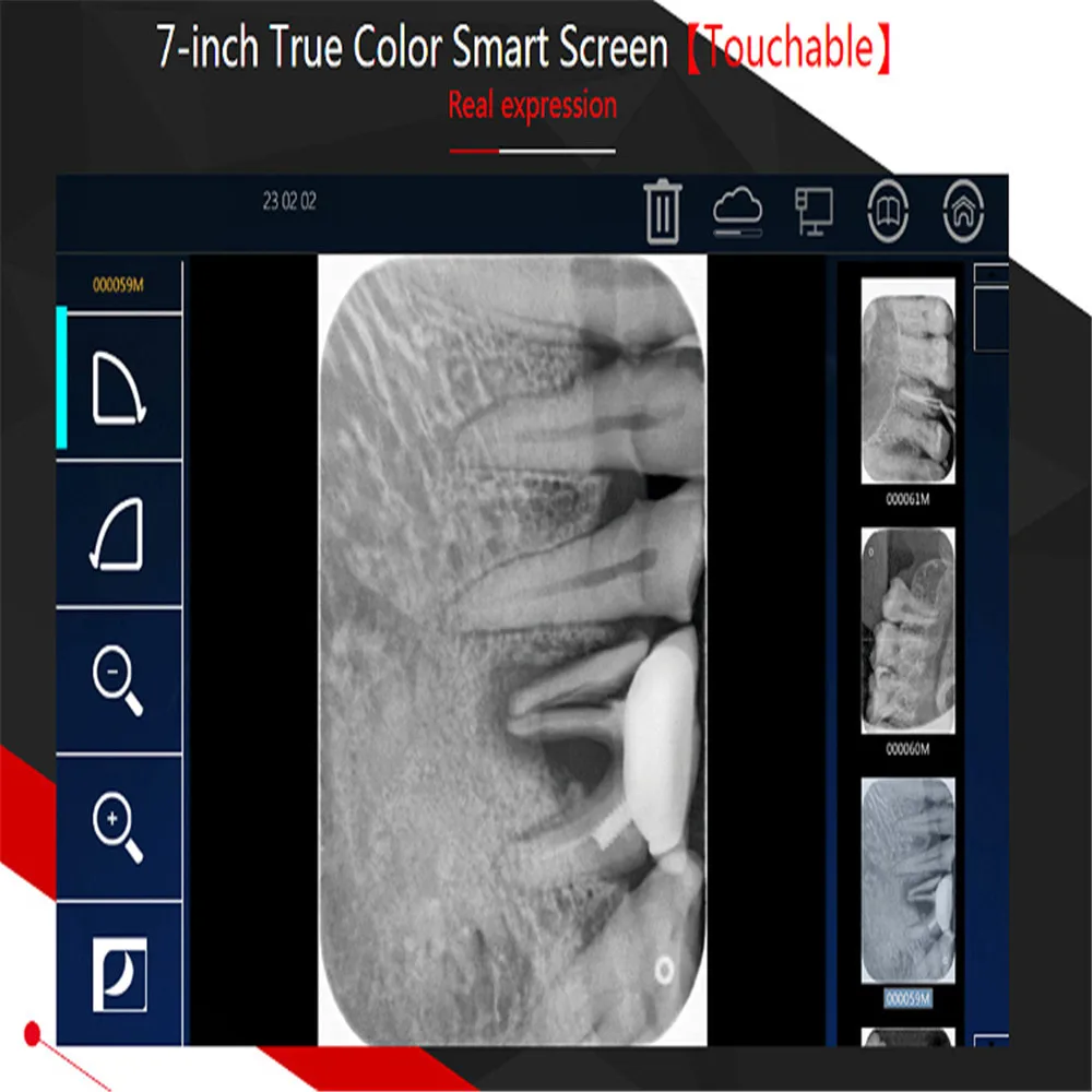 Рисунок 3 - Портативный сканер для стоматологической