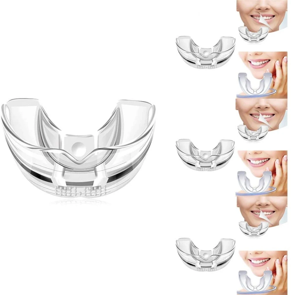 Ensemble Orthodontique Invisible en Silicone, Dispositif Dentaire, Retenue de Dents, Protège-Bouche, Bretelles, Outil de Soins Dentaires, 3 Étapes