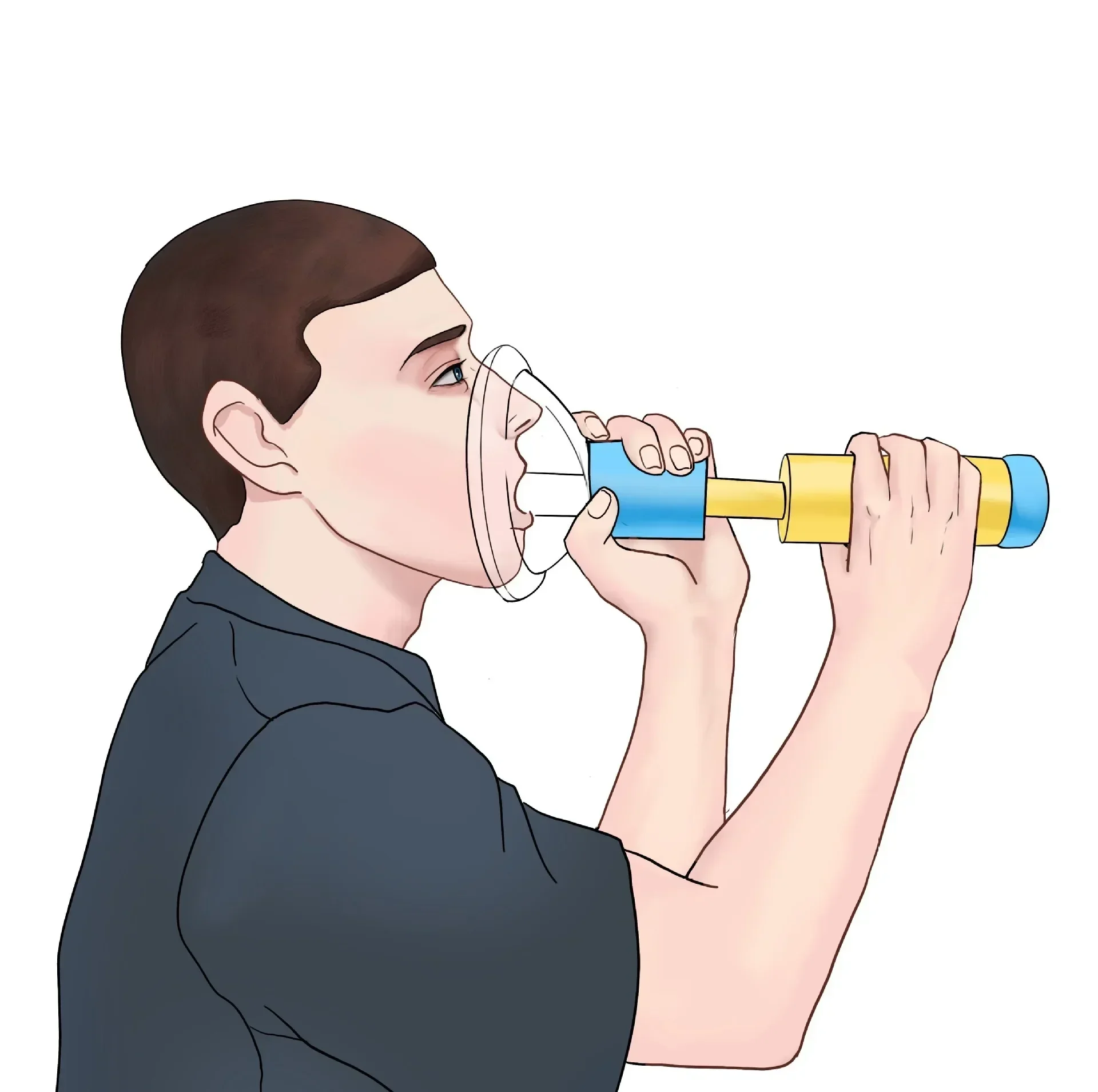 Aggiornamento Dispositivo Portatile Anti Soffocamento Soffocamento Emergenza Risparmio Di Vita Aspirazione Dispositivo Anti Soffocamento Kit Di Pronto